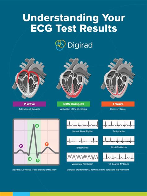 heart stress test results meaning